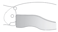 Diagram of a Chris Reeve Integral Lock (R.I.L.)